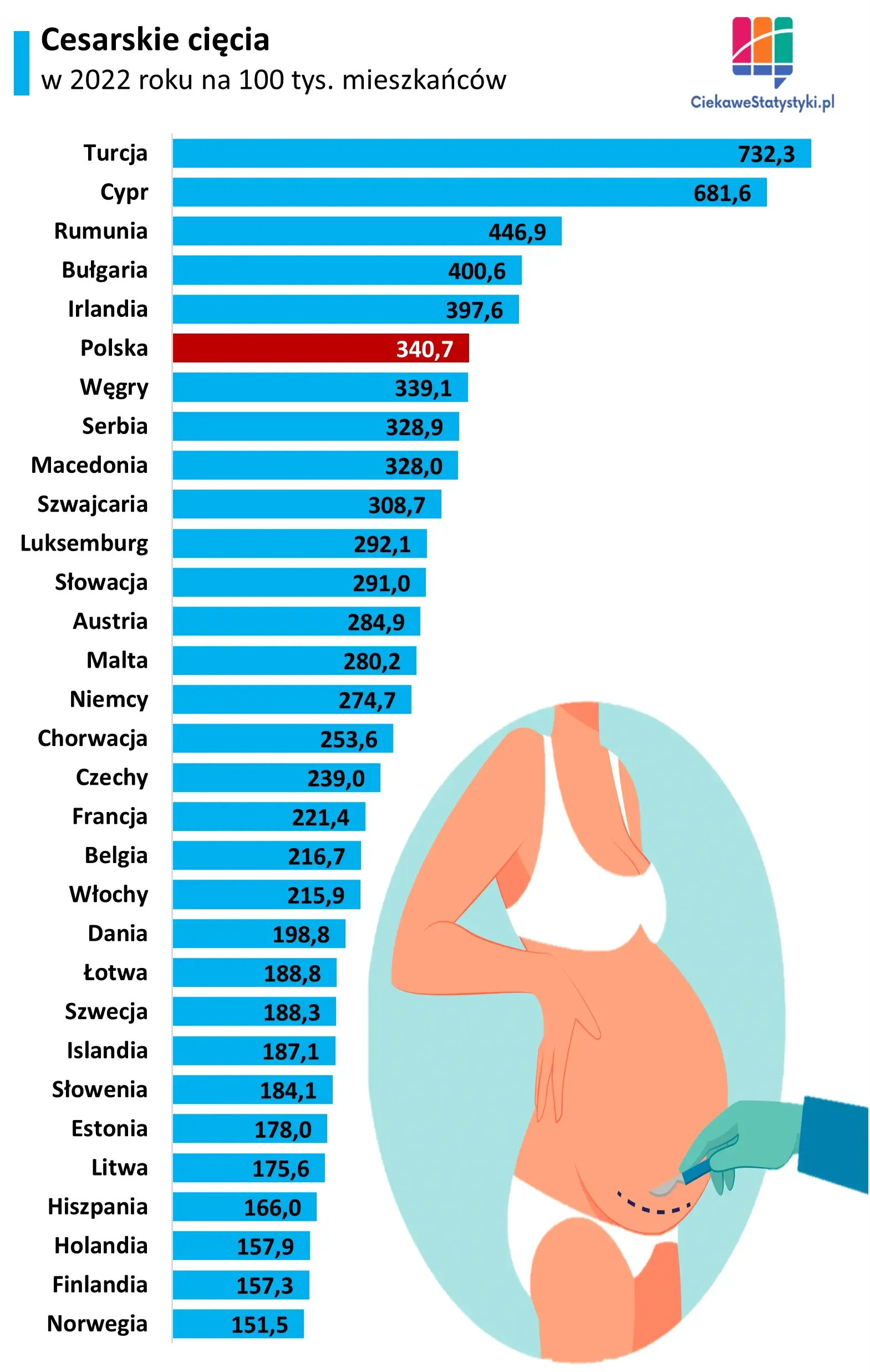 Grafika przedstawia wskaźnik cesarskich cięć w Polsce i w innych krajach Europy w przeliczeniu na 100 tys. mieszkańców